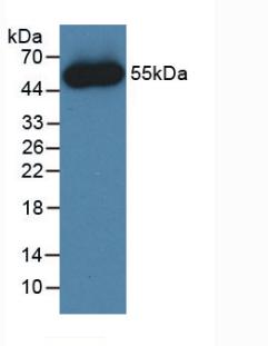 Active Fibroblast Growth Factor 1, Acidic (FGF1)