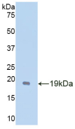 Active Glial Cell Line Derived Neurotrophic Factor (GDNF)