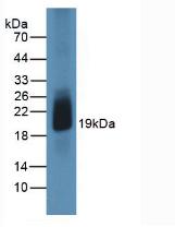 Active Colony Stimulating Factor 2, Granulocyte Macrophage (GM-CSF)