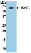 Active Insulin Like Growth Factor Binding Protein 2 (IGFBP2)