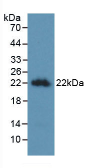 Active Interleukin 10 (IL10)