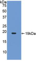 Active Interleukin 17 (IL17)