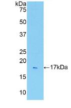 Active Interleukin 1 Receptor Type I (IL1R1)