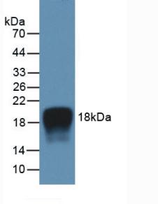 Active Interleukin 2 (IL2)