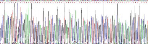 Active Transforming Growth Factor Beta 1 (TGFb1)