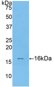 Active Transforming Growth Factor Beta 1 (TGFb1)