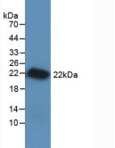 Active Vascular Endothelial Growth Factor A (VEGFA)