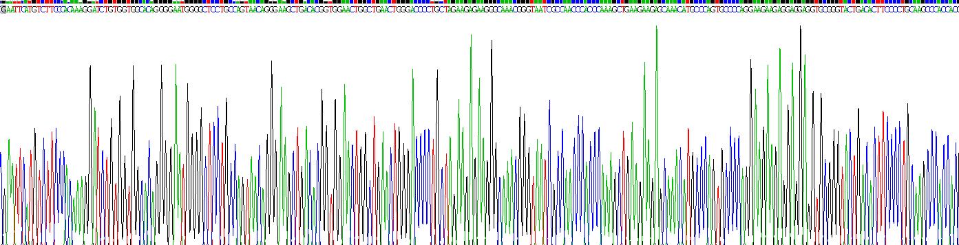 Active Adiponectin Receptor 1 (ADIPOR1)