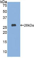 Active Hexosaminidase A Alpha (HEXa)