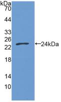 Active Growth Arrest Specific Protein 6 (GAS6)