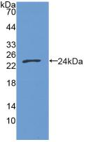 Active Growth Arrest Specific Protein 6 (GAS6)