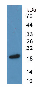 Active Transforming Growth Factor Beta 2 (TGFb2)