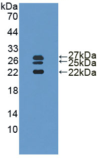 Active Interleukin 1 Receptor Antagonist (IL1RA)