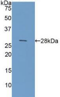 Active Galectin 3 (GAL3)