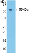 Active Cathepsin A (CTSA)