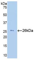 Active Granzyme M (GZMM)