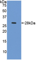 Active Cardiac Troponin I (cTnI)