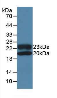 Active Fibroblast Growth Factor 2, Basic (FGF2)