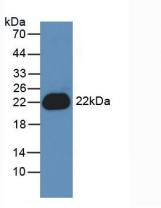 Active Interleukin 1 Beta (IL1b)