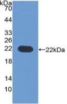 Active Cluster Of Differentiation 276 (CD276)