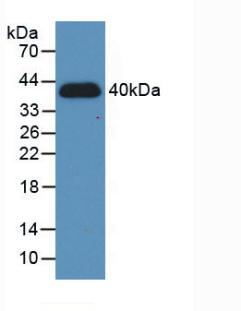 Active Hypoxia Inducible Factor 1 Alpha (HIF1a)