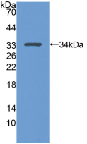 Active Tumor Protein p53 (P53)