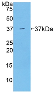 Active Arginase (ARG)