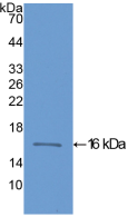 Active Heart-type Fatty Acid Binding Protein (H-FABP)