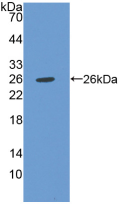 Active Chitinase-3-like Protein 1 (CHI3L1)