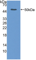 Active Tumor Necrosis Factor Receptor Superfamily, Member 1B (TNFRSF1B)