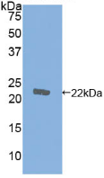 Active Cofilin 1 (CFL1)