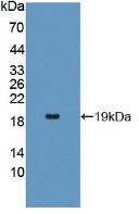 Active Interleukin 17 Receptor A (IL17RA)