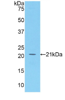 Active B-Cell Activating Factor (BAFF)