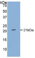 Active Interleukin 25 (IL25)