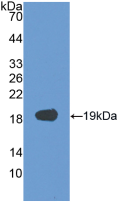 Active Vascular Endothelial Growth Factor 165 (VEGF165)