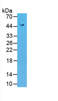 Active Angiotensin I Converting Enzyme 2 (ACE2)