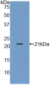 Active Apolipoprotein C3 (APOC3)