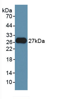 Active Fibroblast Growth Factor 21 (FGF21)