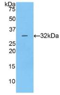 Active Cathepsin V (CTSV)