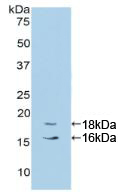 Active Cytochrome P450 1B1 (CYP1B1)