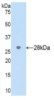 Active Cytochrome P450 2D6 (CYP2D6)