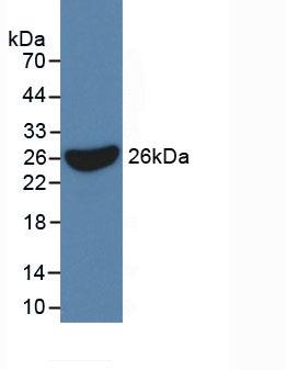 Active Interleukin 17 Receptor C (IL17RC)