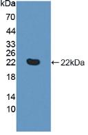 Active Tumor Necrosis Factor Receptor Superfamily, Member 14 (TNFRSF14)