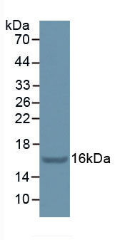 Active Puromycin Sensitive Aminopeptidase (PSA)