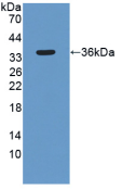 Active Sirtuin 4 (SIRT4)