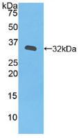 Active Janus Kinase 3 (JAK3)