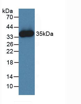 Active Janus Kinase 2 (JAK2)