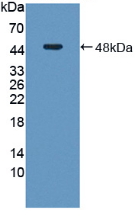 Active Adenosylhomocysteinase (AHCY)