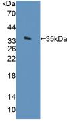 Active Arylsulfatase F (ARSF)