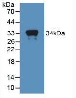 Active Myxovirus Resistance 1 (MX1)